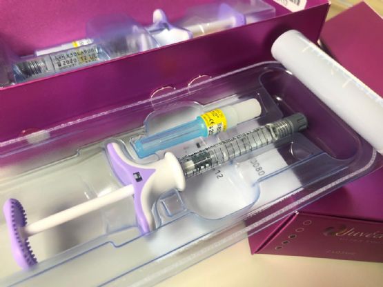 Xhel per fryrje buzesh me acidi hialuronik dhe me lidokaine, anestetik lokal per buzet, mbushes dermal Juvederm Smile qe injektohet ne buze, nga Klinika Dermatologjike Venus, Dr Brunilda Bardhi